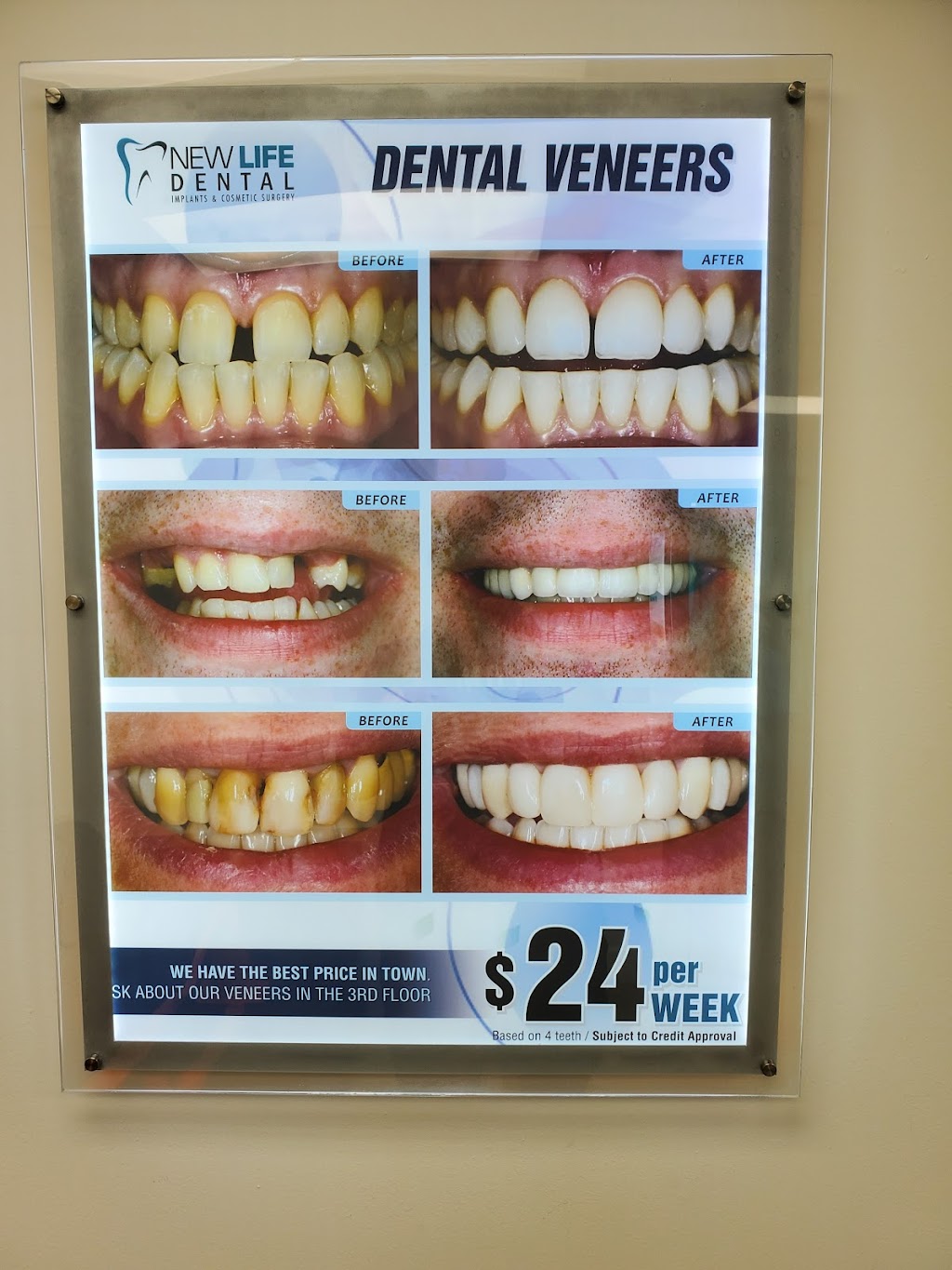 New Life Dental | 8740 N Kendall Dr #214, Miami, FL 33176, USA | Phone: (305) 509-6337