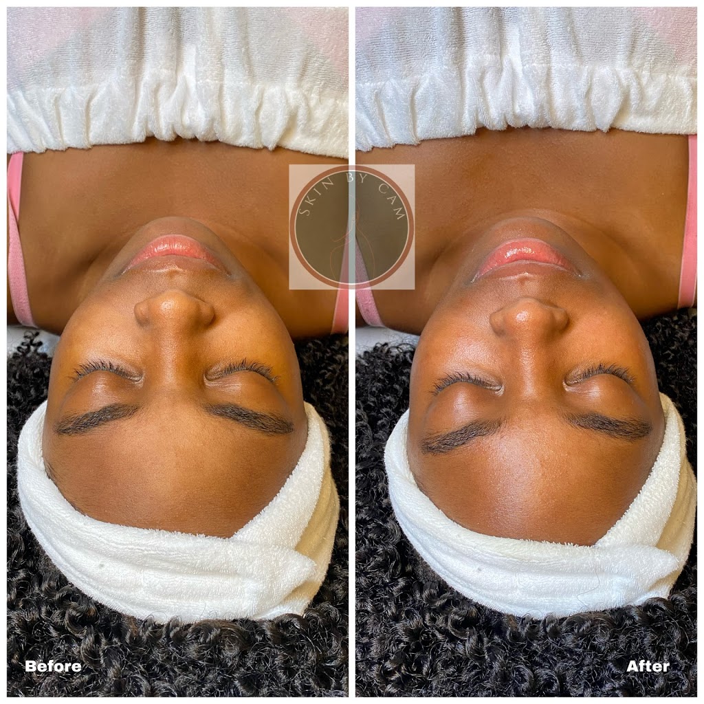 Skin By Cam, LLC | 4600 Powder Mill Rd Suite 450-S32, Beltsville, MD 20705, USA | Phone: (443) 765-1064