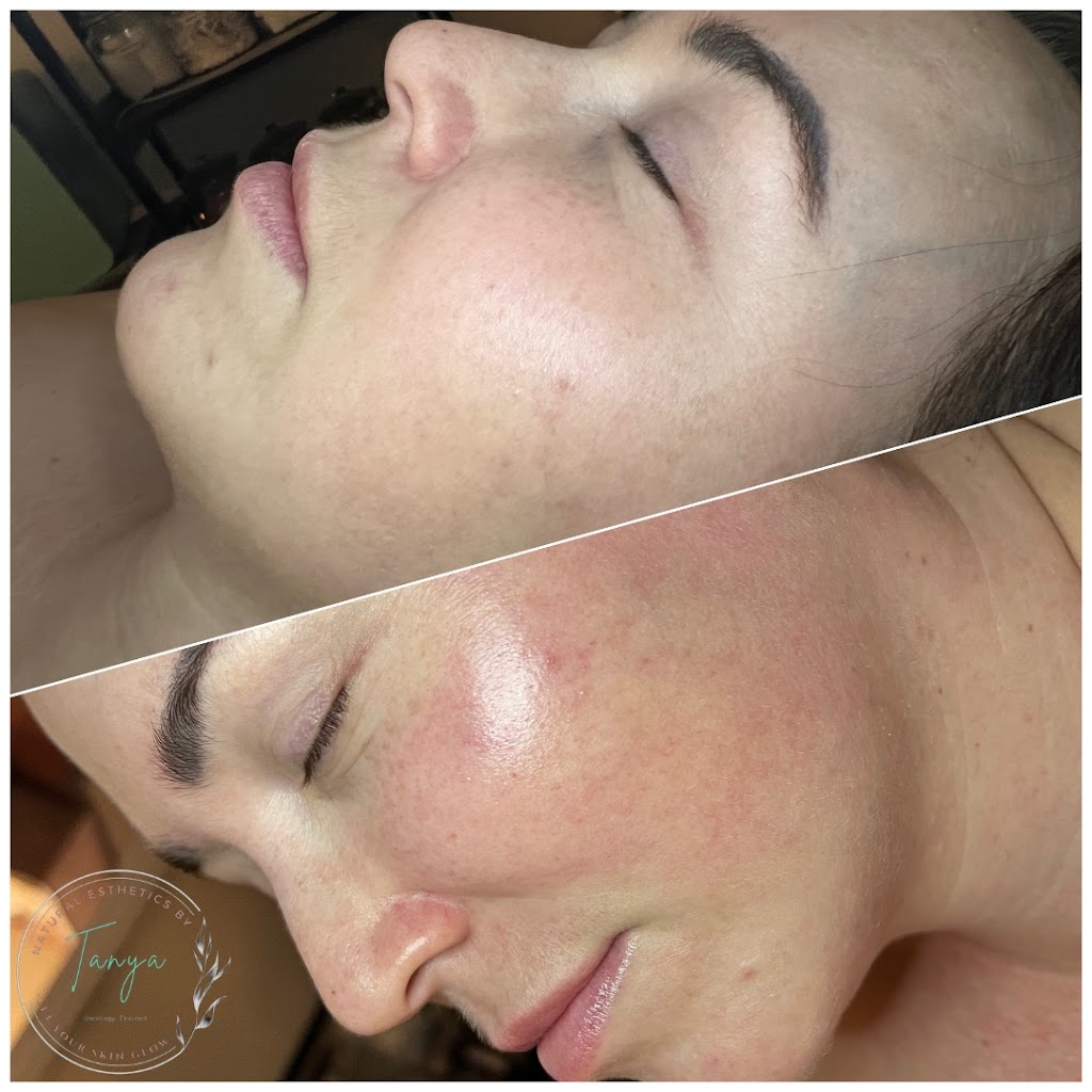 Natural Esthetics by Tanya | 110 Panorama Loop Suite F, Waxahachie, TX 75165, USA | Phone: (214) 949-5060