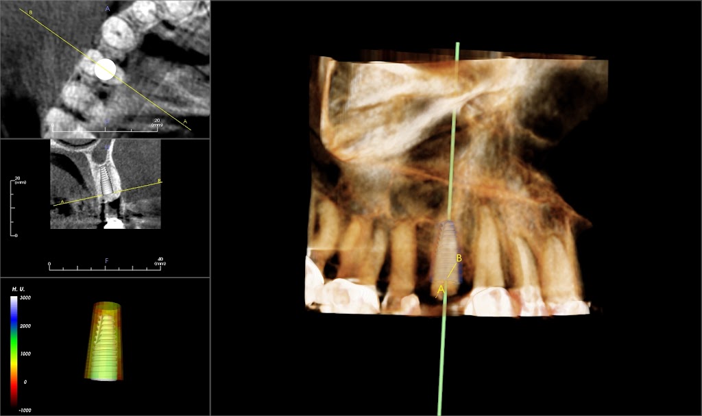 Bellflower Oral Facial Surgery & Dental Implant Center | 14343 Bellflower Blvd, Bellflower, CA 90706, USA | Phone: (562) 866-1111