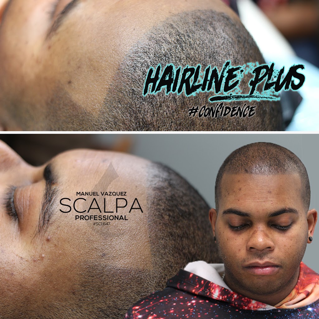 Hairline Plus | 1050 Stuyvesant Ave, Union, NJ 07083, USA | Phone: (908) 318-4018