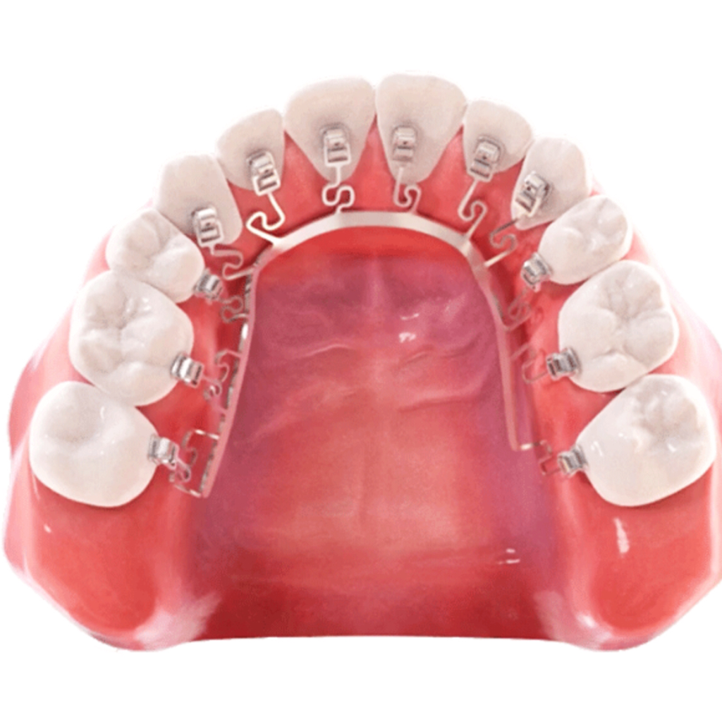 3D Smiles Dental | 1102 S Washington St, Kaufman, TX 75142, USA | Phone: (972) 932-4551