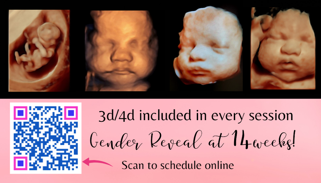 Life Imaging 3d 4d HD Ultrasound Studio | 471 Mariner Blvd, Spring Hill, FL 34609, USA | Phone: (352) 573-5141