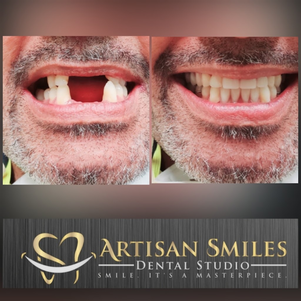 Artisan Smiles Dental Studio | 2613 A, 2613 B, 2613 W Mercury Blvd, Hampton, VA 23666, USA | Phone: (757) 826-7372