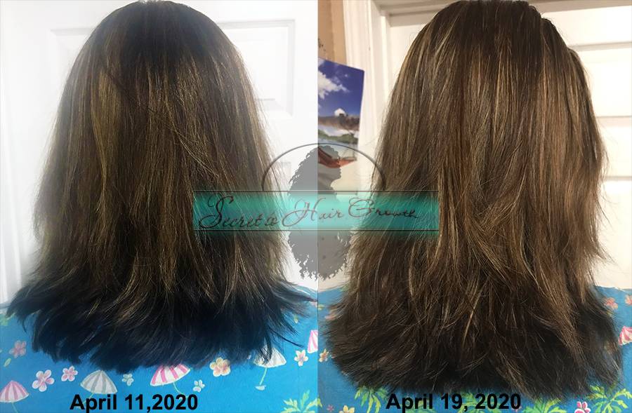 CMOSOMEL- Secret to Hair Growth | 11714 Crest Creek Dr, Riverview, FL 33569, USA | Phone: (813) 466-1500