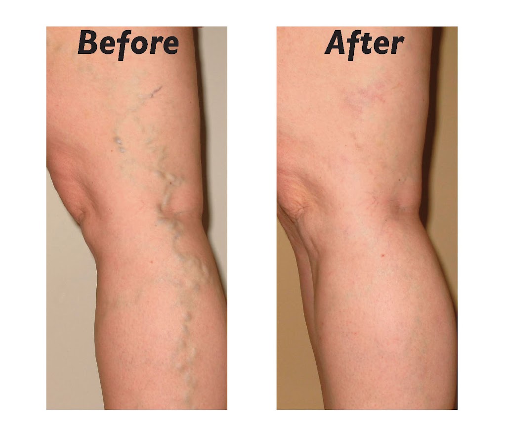 Charming Skin & Vein Clinics | 638 N Addison Rd, Villa Park, IL 60181 | Phone: (630) 974-1400