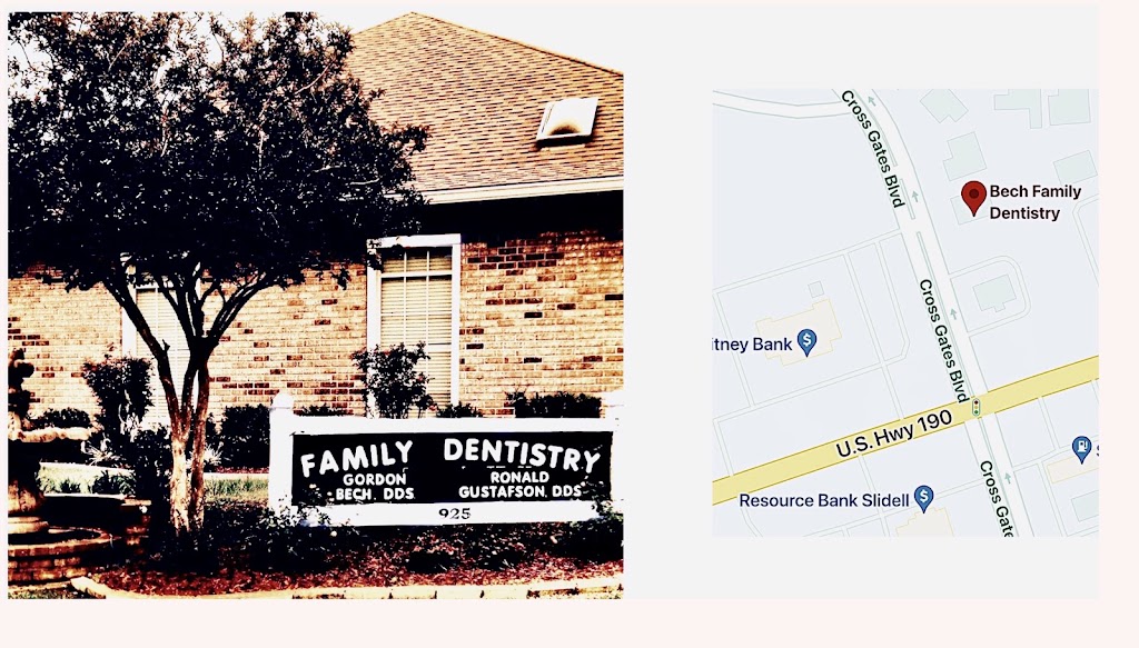 Bech Family Dentistry | 925 Cross Gates Blvd, Slidell, LA 70461 | Phone: (985) 641-4180