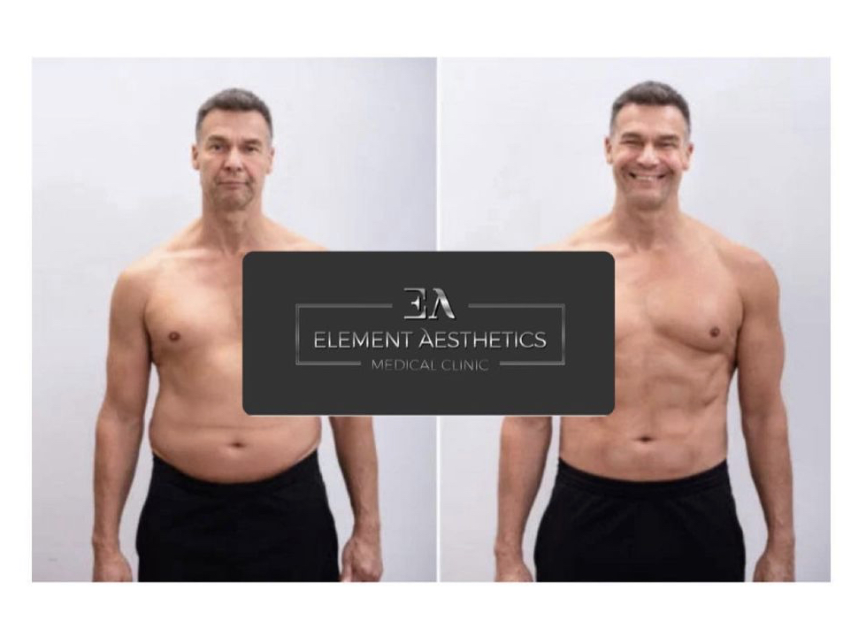 Element Aesthetics Wellness Clinic LLC | 2012 N Riverside Ave Ste. F, Rialto, CA 92377, USA | Phone: (909) 961-2365