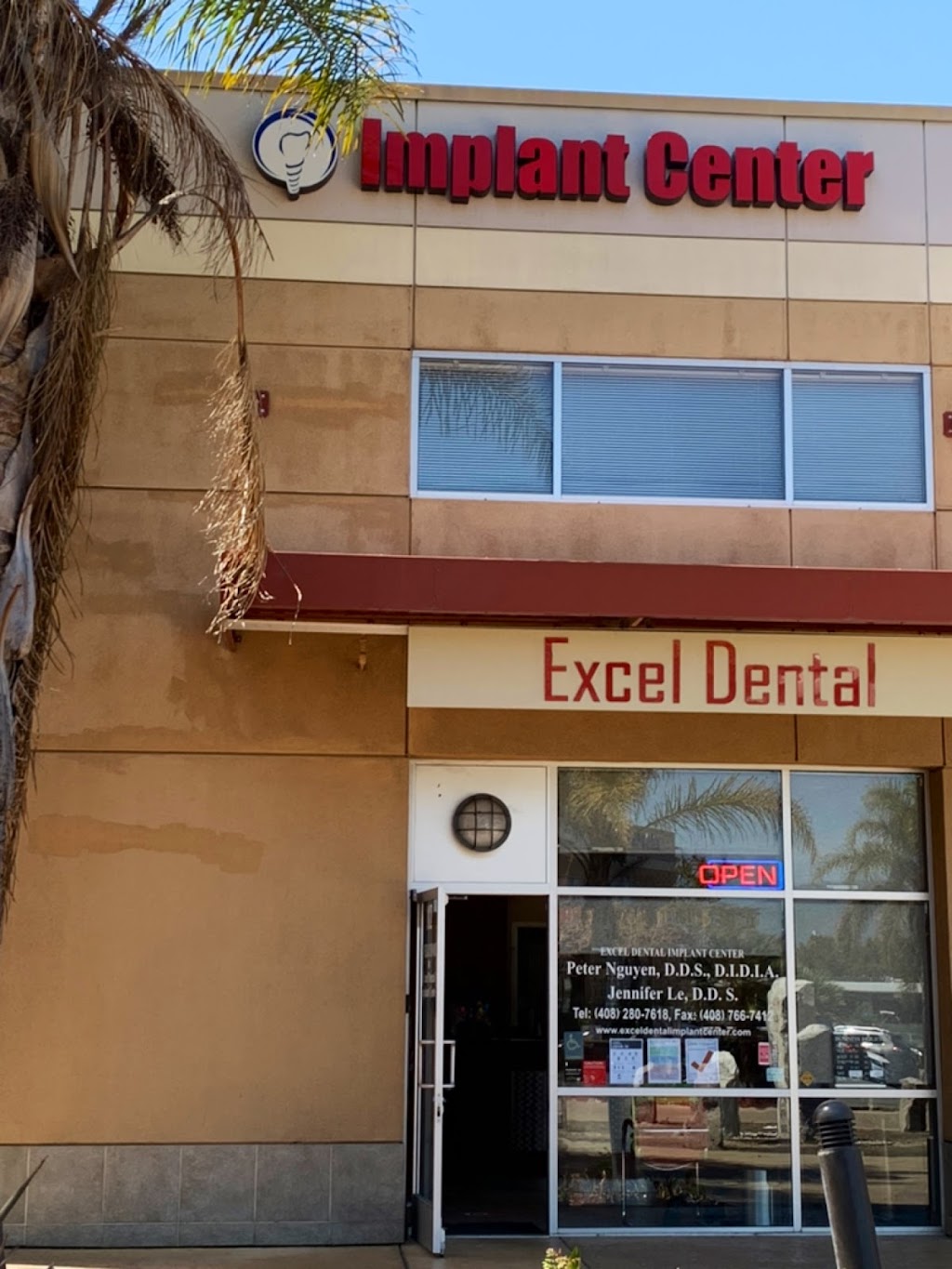 Excel Dental Implant Center | 88 Tully Rd #112, San Jose, CA 95111, USA | Phone: (408) 280-7618