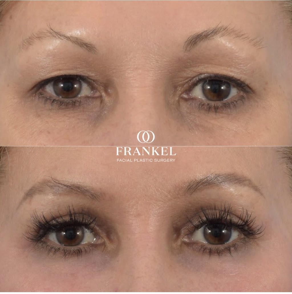 Frankel Facial Plastic Surgery, LLC: Jonathan Frankel, MD | 5885 Landerbrook Dr Suite 150, Mayfield Heights, OH 44124, USA | Phone: (216) 399-9550