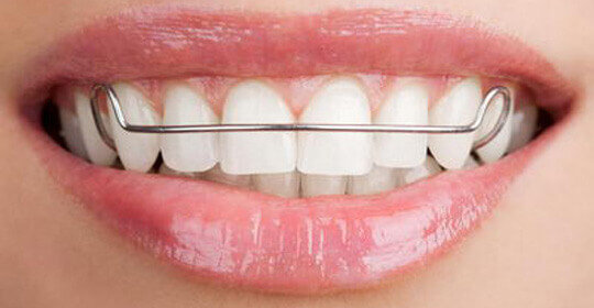 Full Smile Orthodontics | 6965 El Camino Real #201, Carlsbad, CA 92009, USA | Phone: (760) 804-0080