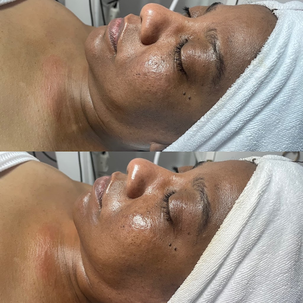 Strickly Skin Esthetics | 105 E Oak St Ste. 101, Mansfield, TX 76063, USA | Phone: (817) 320-8485