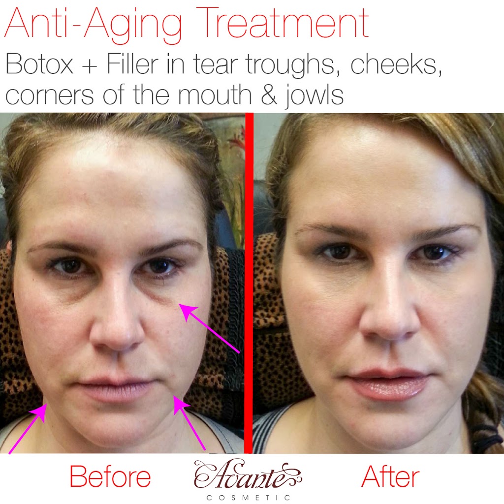 Avante Cosmetic | 9035 Wadsworth Pkwy #3650, Westminster, CO 80021, USA | Phone: (720) 352-4447