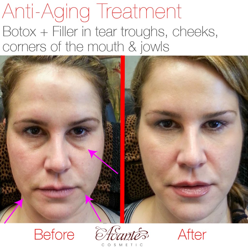 Avante Cosmetic | 9035 Wadsworth Pkwy #3650, Westminster, CO 80021 | Phone: (720) 352-4447