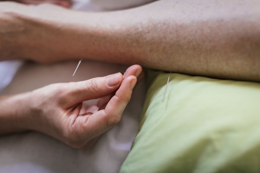 Classical Acupuncture Clinic | 150 Iowa Ln Suite 101, Cary, NC 27511, USA | Phone: (919) 395-2291