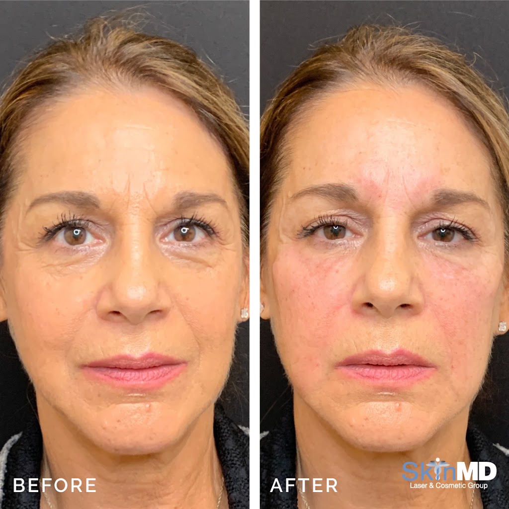 Skin MD Norwell | 400 Washington St, Norwell, MA 02061, USA | Phone: (781) 659-4900