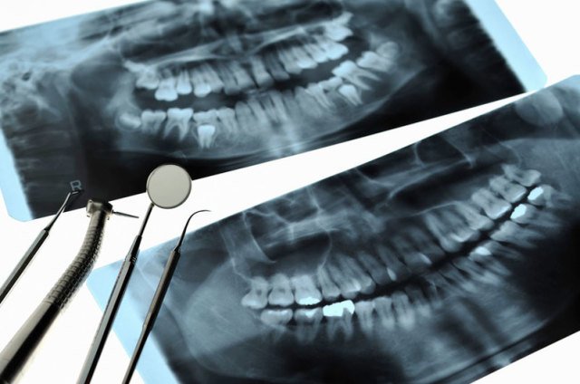 Grand Dental Center | 836 S Grand Ave, Glendora, CA 91740 | Phone: (626) 852-1711