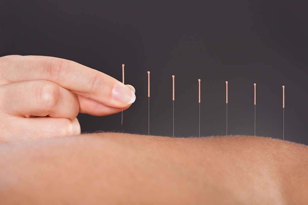 Affordable Acupuncture & Miami Massage Clinic | 17045 S Dixie Hwy, Palmetto Bay, FL 33157, USA | Phone: (305) 232-2200