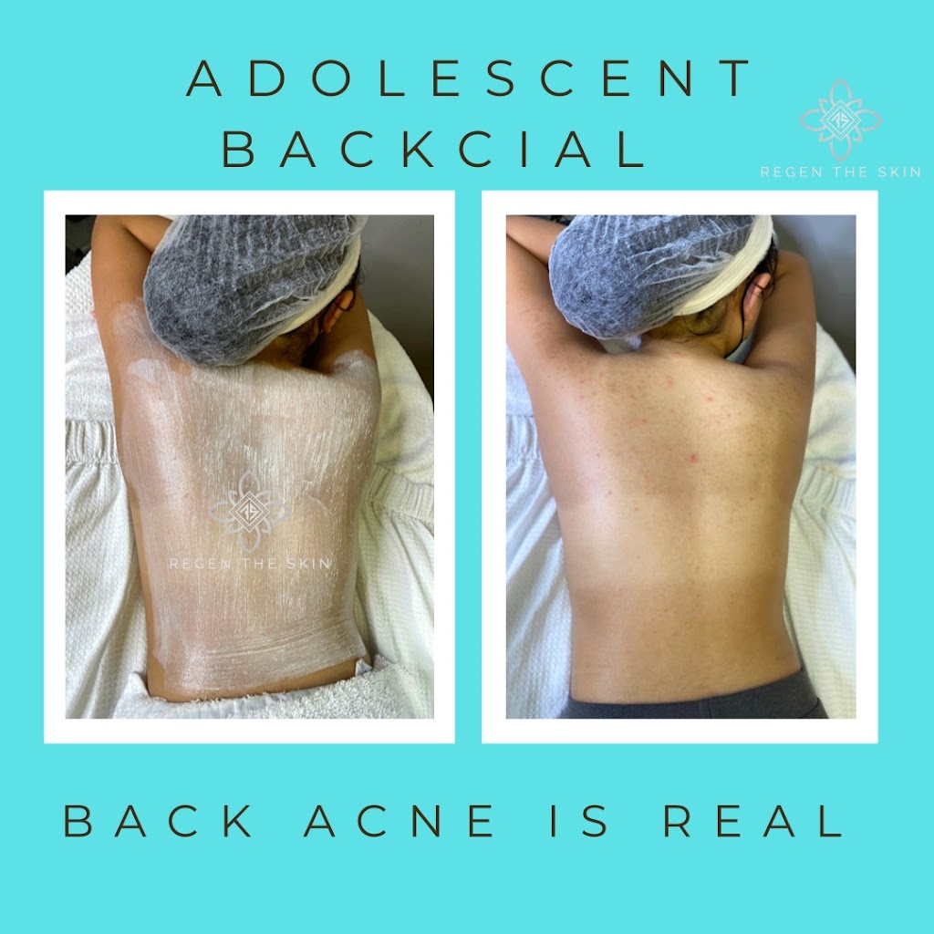 Regen The Skin | 2485 Old Washington Rd, Waldorf, MD 20601, USA | Phone: (240) 412-3096