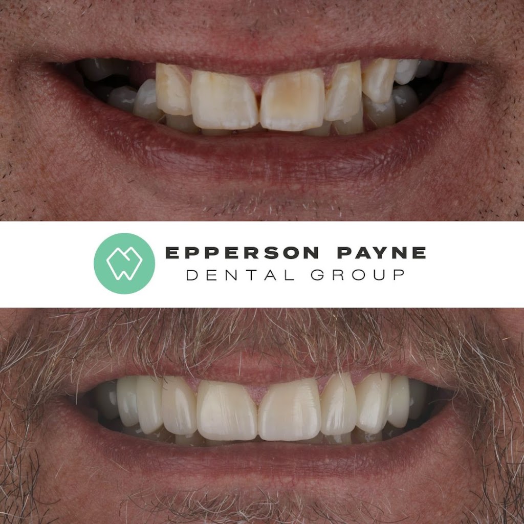 Epperson Payne Dental Group | 8220 Memphis Ave, Lubbock, TX 79423, USA | Phone: (806) 745-1745