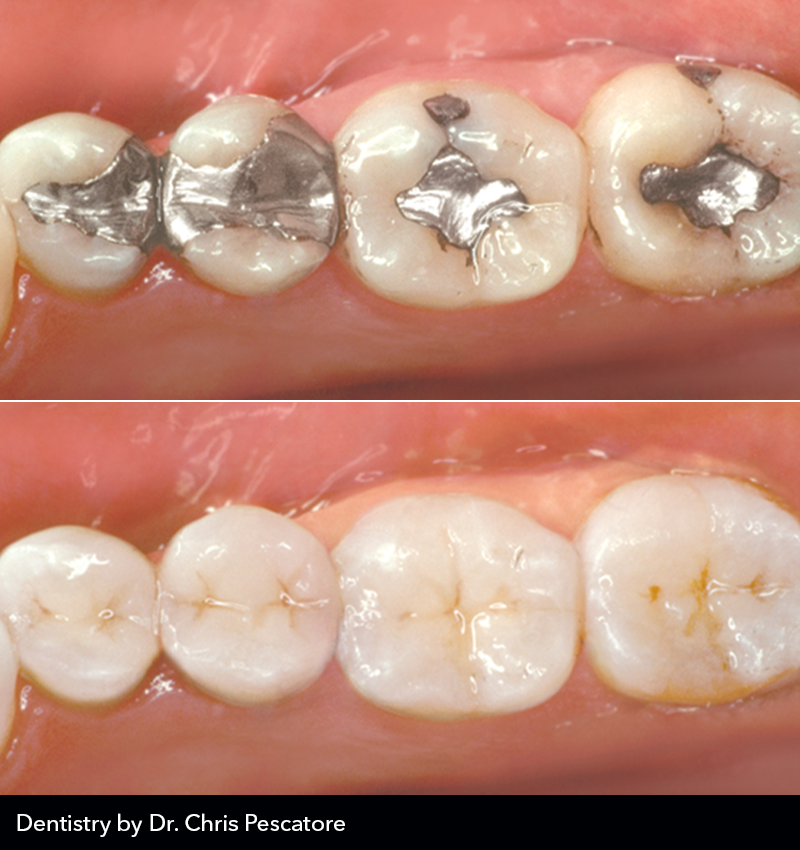 MicroDental Las Vegas Laboratory | 1401 Hillshire Dr # 110, Las Vegas, NV 89134, USA | Phone: (702) 458-1079