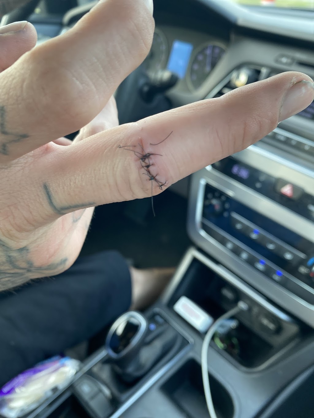 Walk In Urgent Care | 4340 N Leavitt Rd D, Lorain, OH 44053, USA | Phone: (440) 444-0497