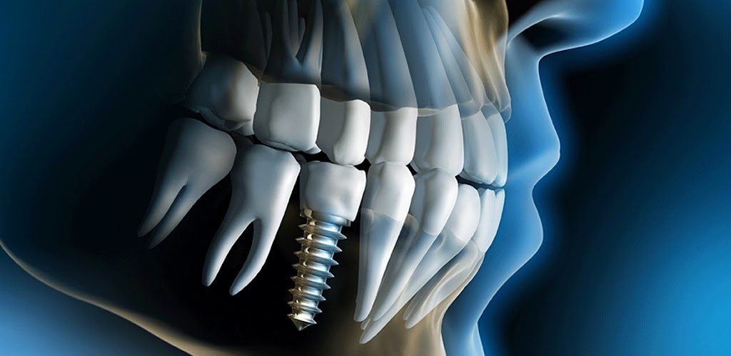 Cary Oral Surgery | 1010 High House Rd # 100, Cary, NC 27513, USA | Phone: (919) 461-0110