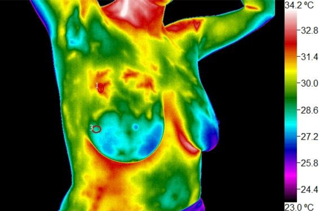 InfraRead: Thermography for Wellness | 8700 Auburn Folsom Rd suite 300, Granite Bay, CA 95746 | Phone: (916) 741-2522