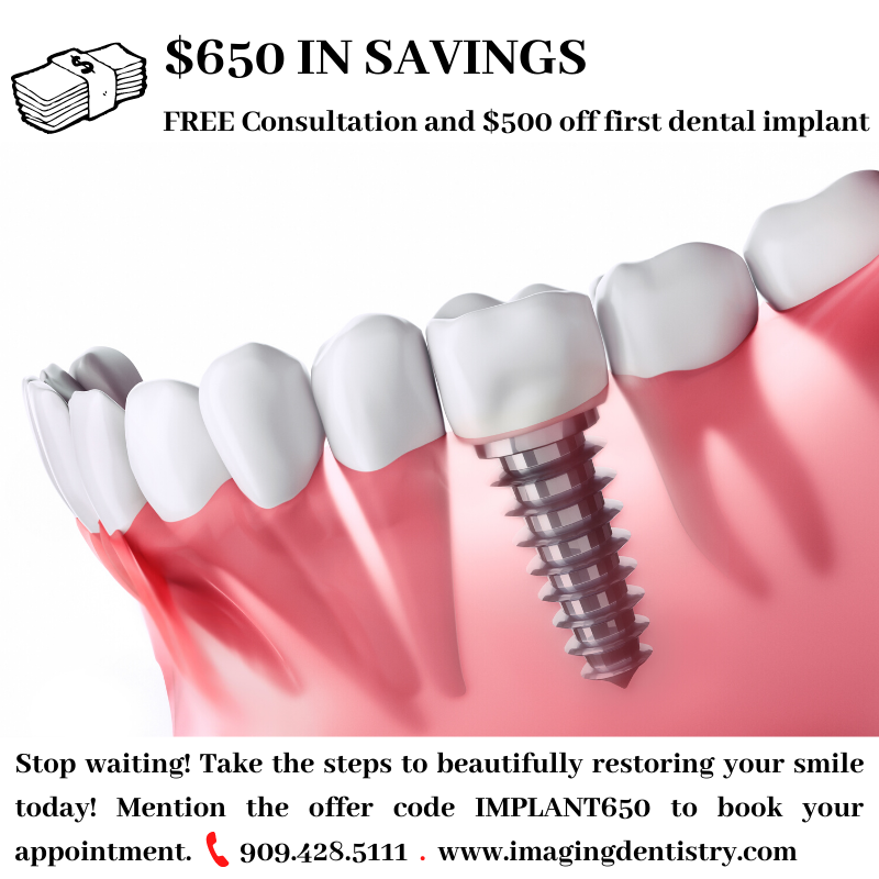 Vahan Grigoryan DDS: Imaging Dentistry | 536 E Foothill Blvd, Upland, CA 91786, USA | Phone: (909) 291-8625