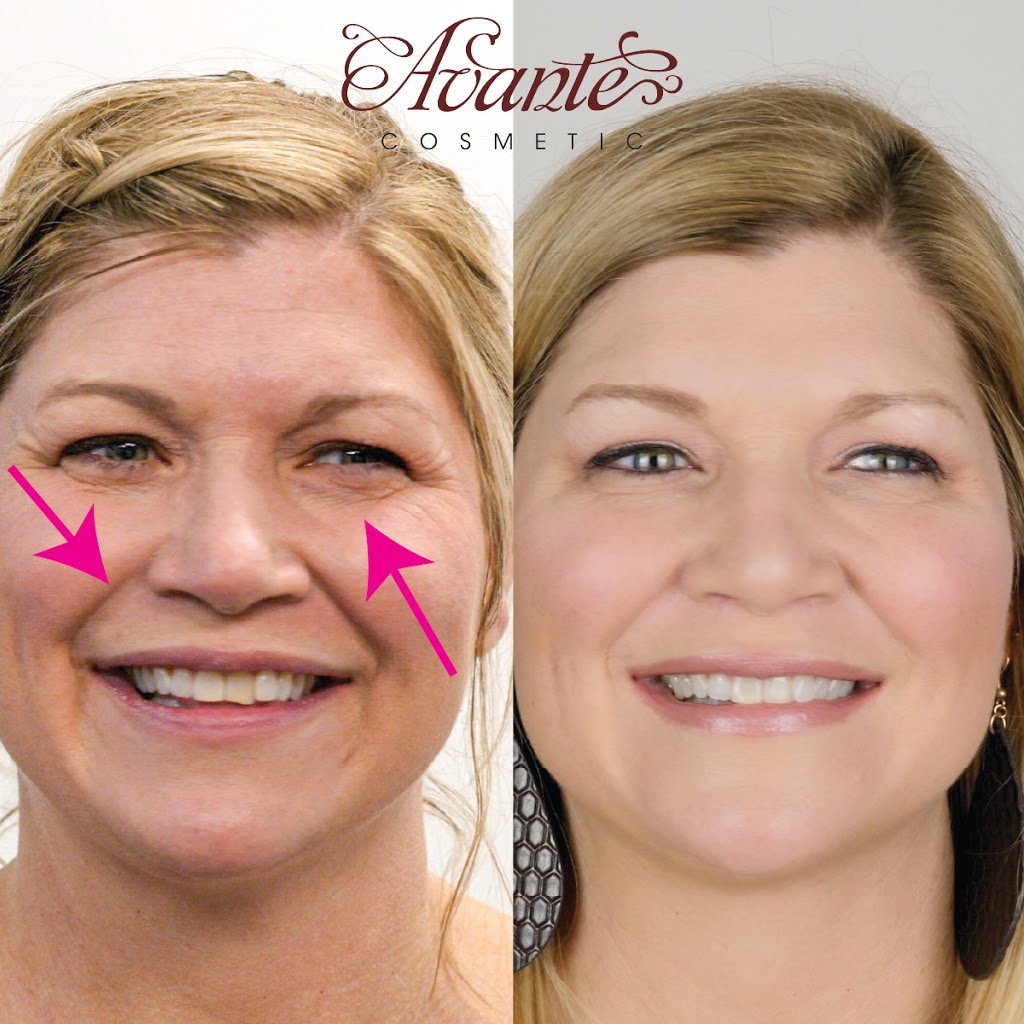 Avante Cosmetic | 9035 Wadsworth Pkwy #3650, Westminster, CO 80021 | Phone: (720) 352-4447