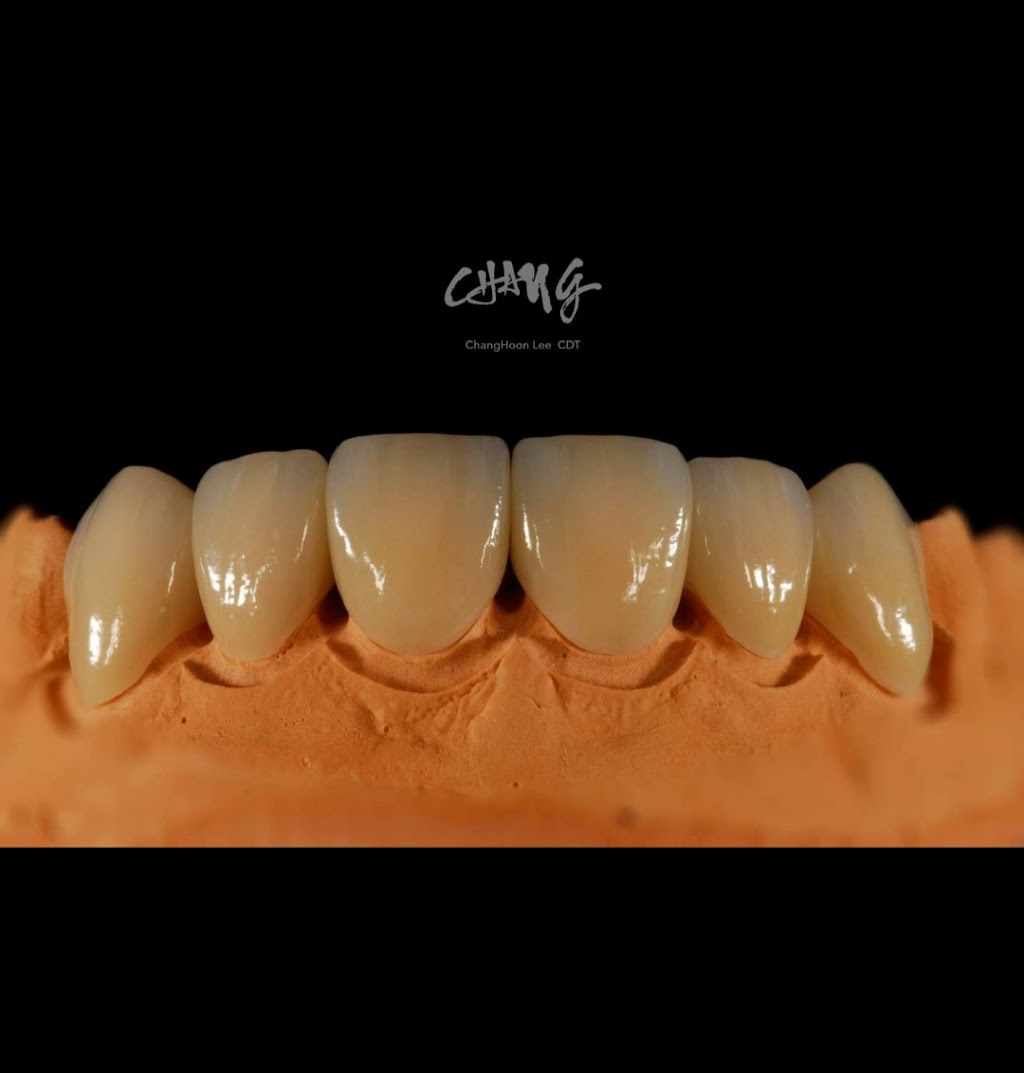 Prestige Line Dental Studio | 6011 Morriss Rd Suite 100, Flower Mound, TX 75028, USA | Phone: (469) 630-0186