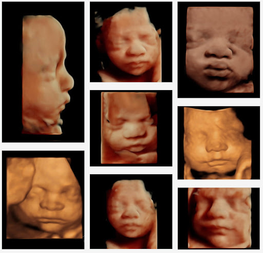 3D 4D Ultrasound by 4D Special Delivery | 8632 Archibald Ave UNIT 109, Rancho Cucamonga, CA 91730, USA | Phone: (800) 604-4014