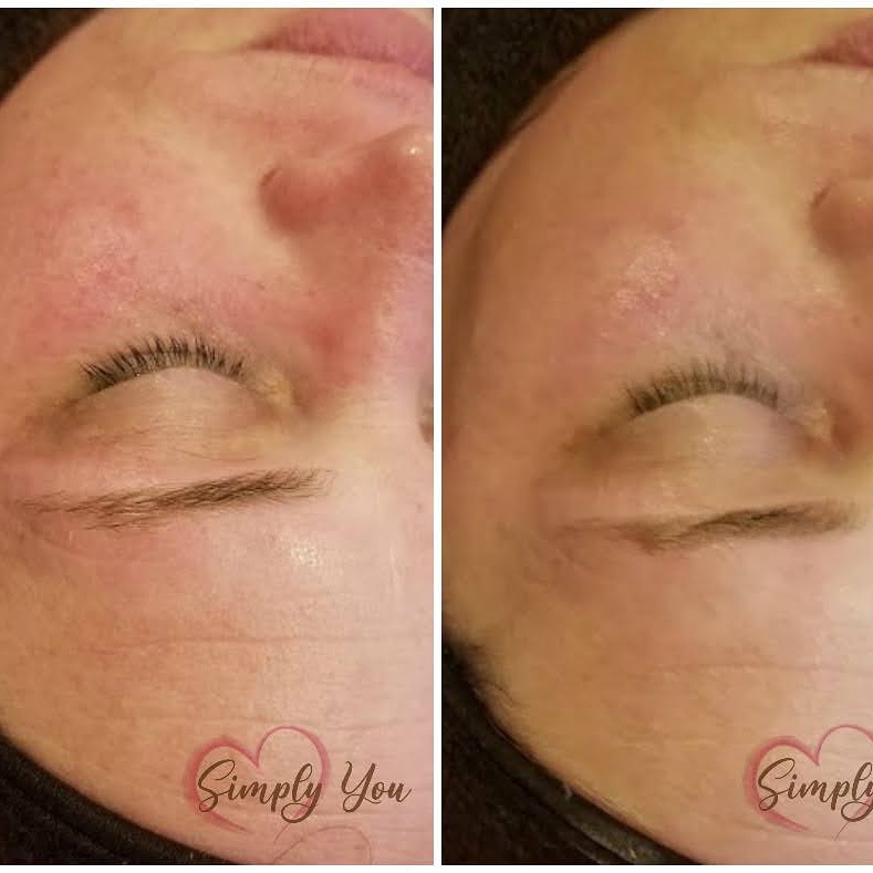 Simply You Skincare Studio | 5340 N Sweetbriar Dr, Milton, WI 53563, USA | Phone: (608) 751-2927