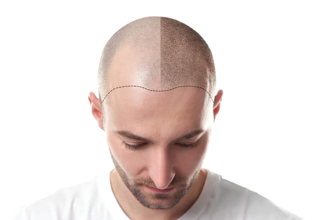 Paramedical Pigments Beauty Co. - Scalp Micropigmentation studio & Day Spa | second floor, 1329 E Kemper Rd Suite 4218 F, Cincinnati, OH 45246 | Phone: (513) 641-8516