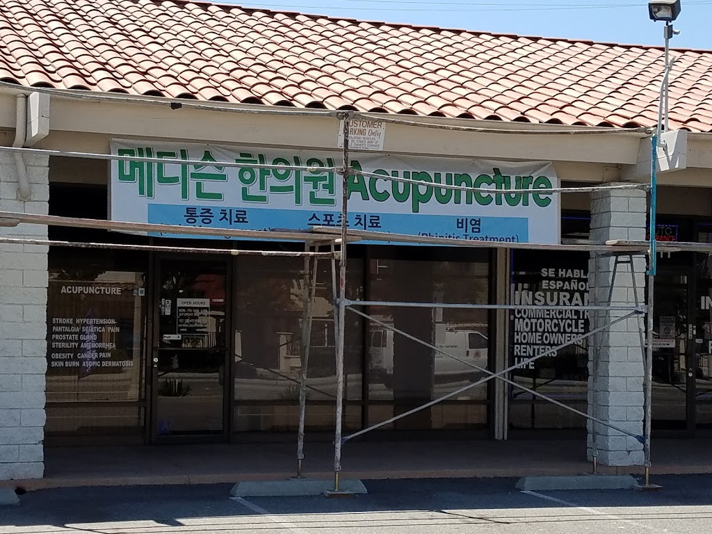 MedsAcu (Oriental Medicine Rehabilitation ) | 715 S Euclid St, Fullerton, CA 92832 | Phone: (714) 869-3655