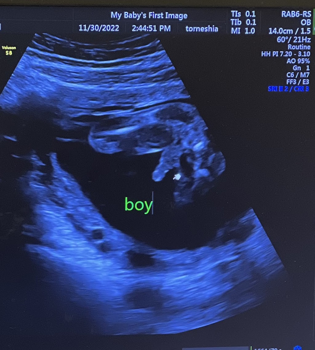 My babys first image | 575 Old Norcross Rd suit H, Lawrenceville, GA 30046, USA | Phone: (470) 628-8677