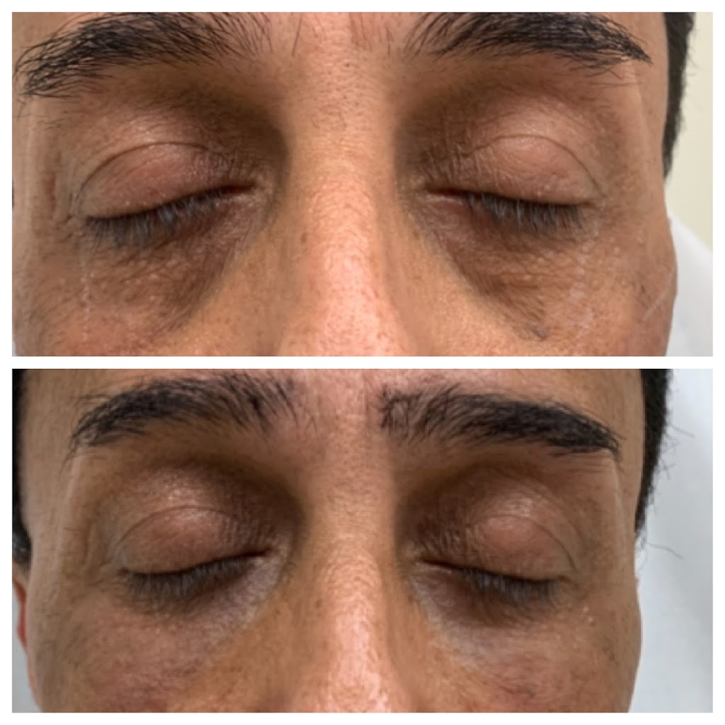 BUTEX Medical spa and Laser treatment | 11445 Dallas Pkwy 250, Suite 43, Frisco, TX 75034, USA | Phone: (469) 432-0868