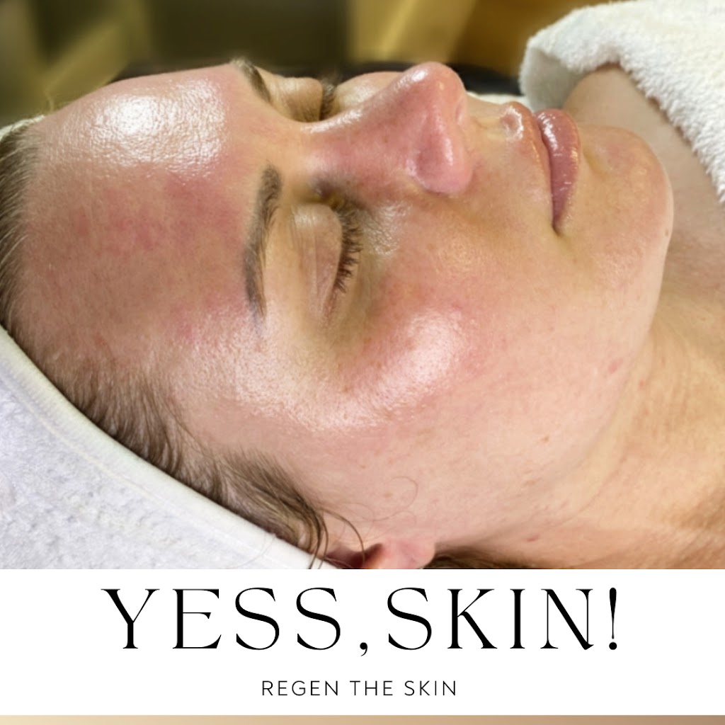 Regen The Skin | 2485 Old Washington Rd, Waldorf, MD 20601, USA | Phone: (240) 412-3096