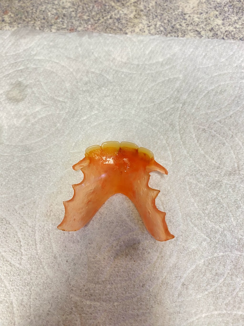 Martigon Dental Lab | 12684 Atherton Dr, Moreno Valley, CA 92555, USA | Phone: (951) 247-3459