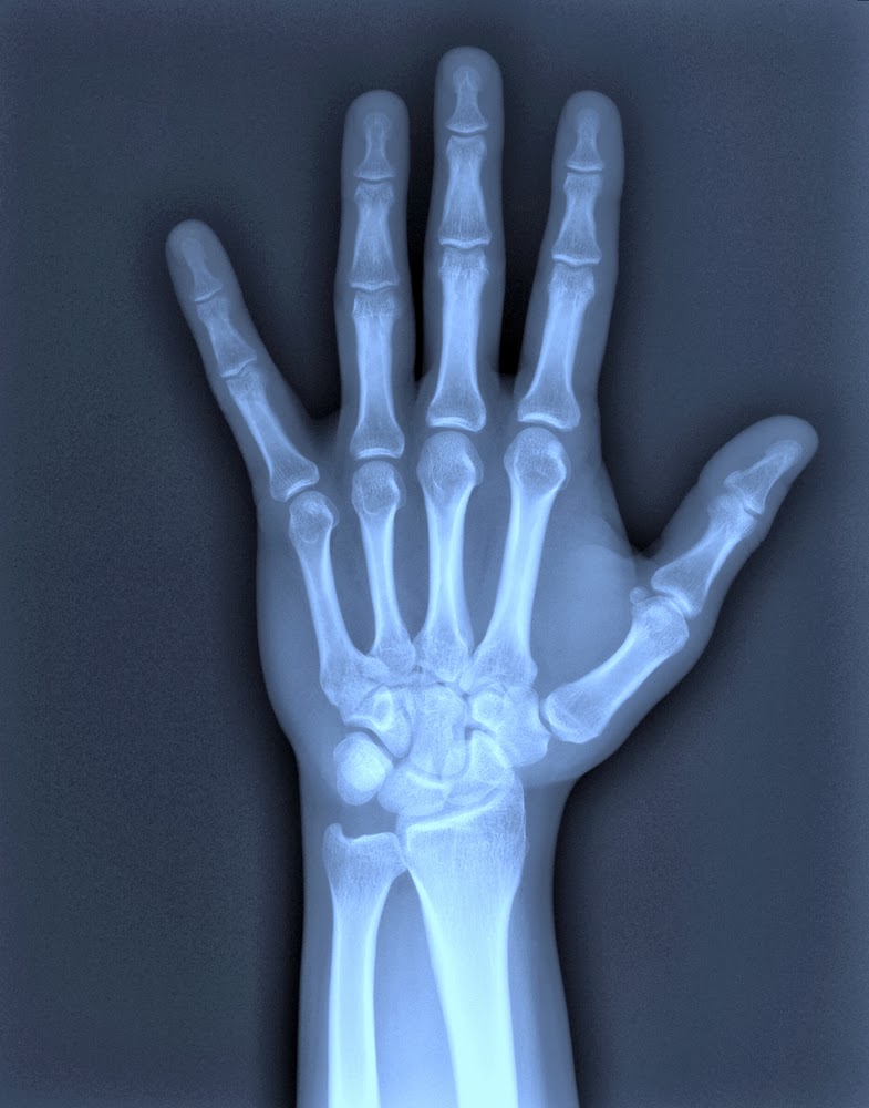 Dr. Jonathan Kalman NMD | 345 S Coast Hwy 101 Unit A, Encinitas, CA 92024, USA | Phone: (619) 777-6567 Dr. Jonathan Kalman NMD | 345 S Coast Hwy 101 Unit A, Encinitas, CA 92024, USA | Phone: (619) 777-6567