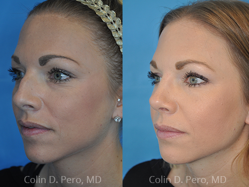 North Texas Facial Plastic Surgery | 5426 W Spring Creek Pkwy Suite 145, Plano, TX 75024, USA | Phone: (469) 437-7041