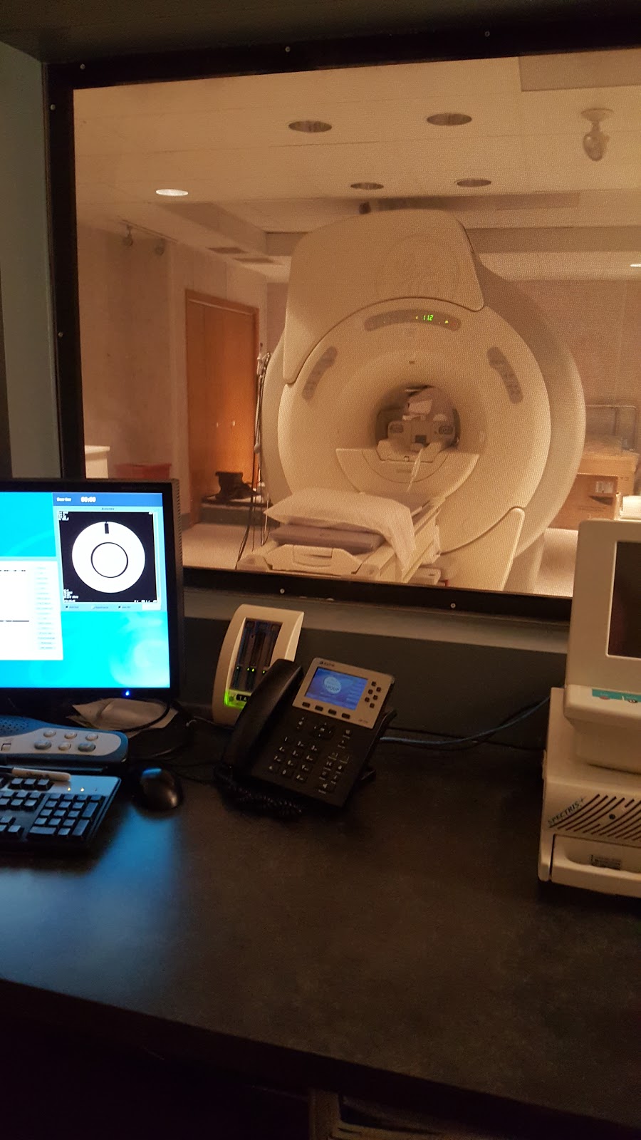 Lockport MRI | 170 Professional Pkwy, Lockport, NY 14094, USA | Phone: (716) 438-2400