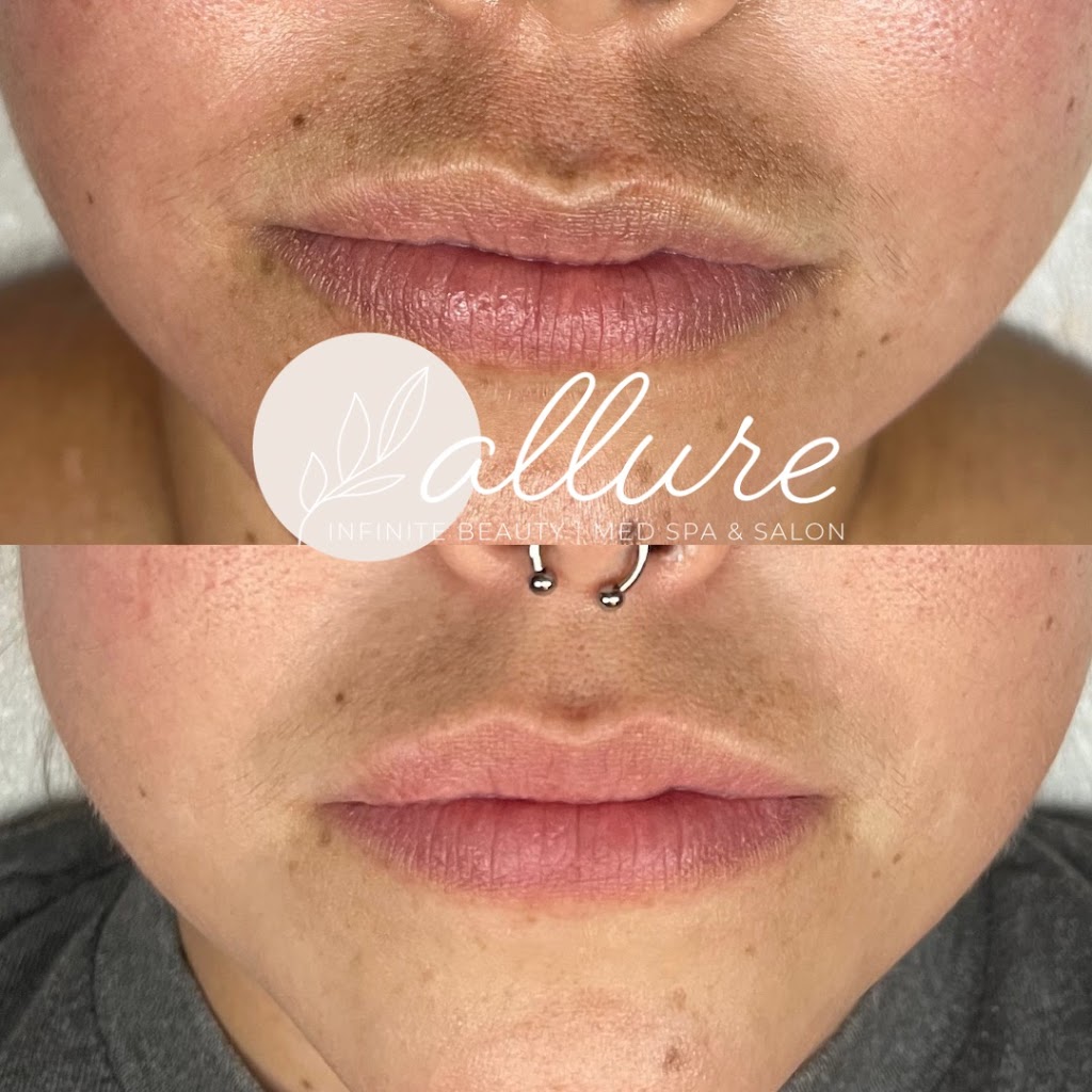 Allure Infinite Beauty | 2421 E Southern Ave #1, Tempe, AZ 85282, USA | Phone: (480) 831-7109