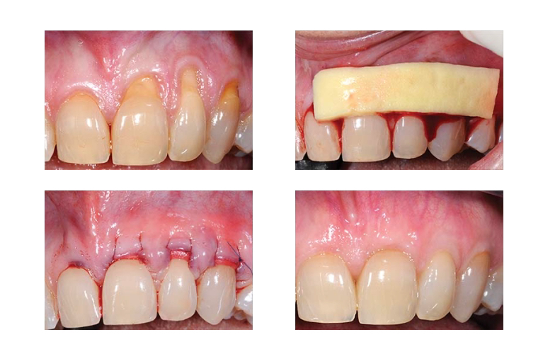 Harbor Implant and Cosmetic Dentistry | 1460 North Harbor Blvd., Suite 120, Fullerton, CA 92835 | Phone: (714) 990-6969