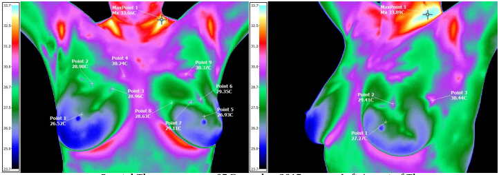 THERMOGRAPHY CLINIC | 3060 Ogden Ave #200, Lisle, IL 60532, USA | Phone: (630) 778-2195