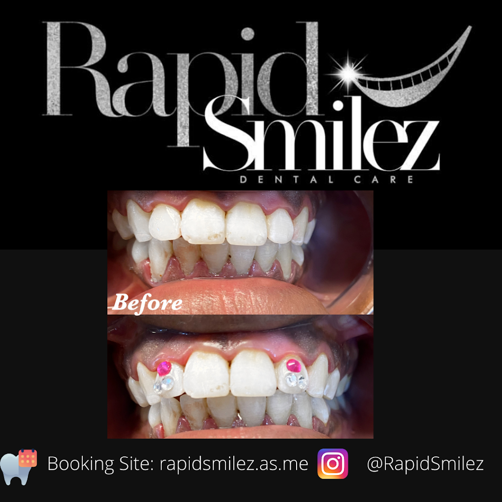 Rapid Smilez | 5611 W Fayetteville Rd #101, Atlanta, GA 30349, USA | Phone: (866) 438-8837