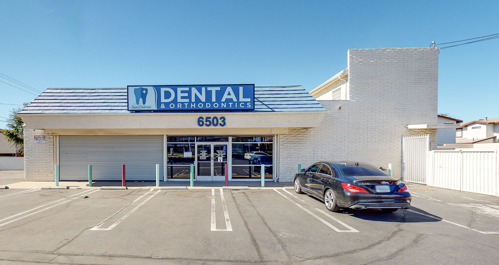 San Gabriel Valley Family Dental Group | 6503 Rosemead Blvd, San Gabriel, CA 91775, USA | Phone: (626) 286-2156