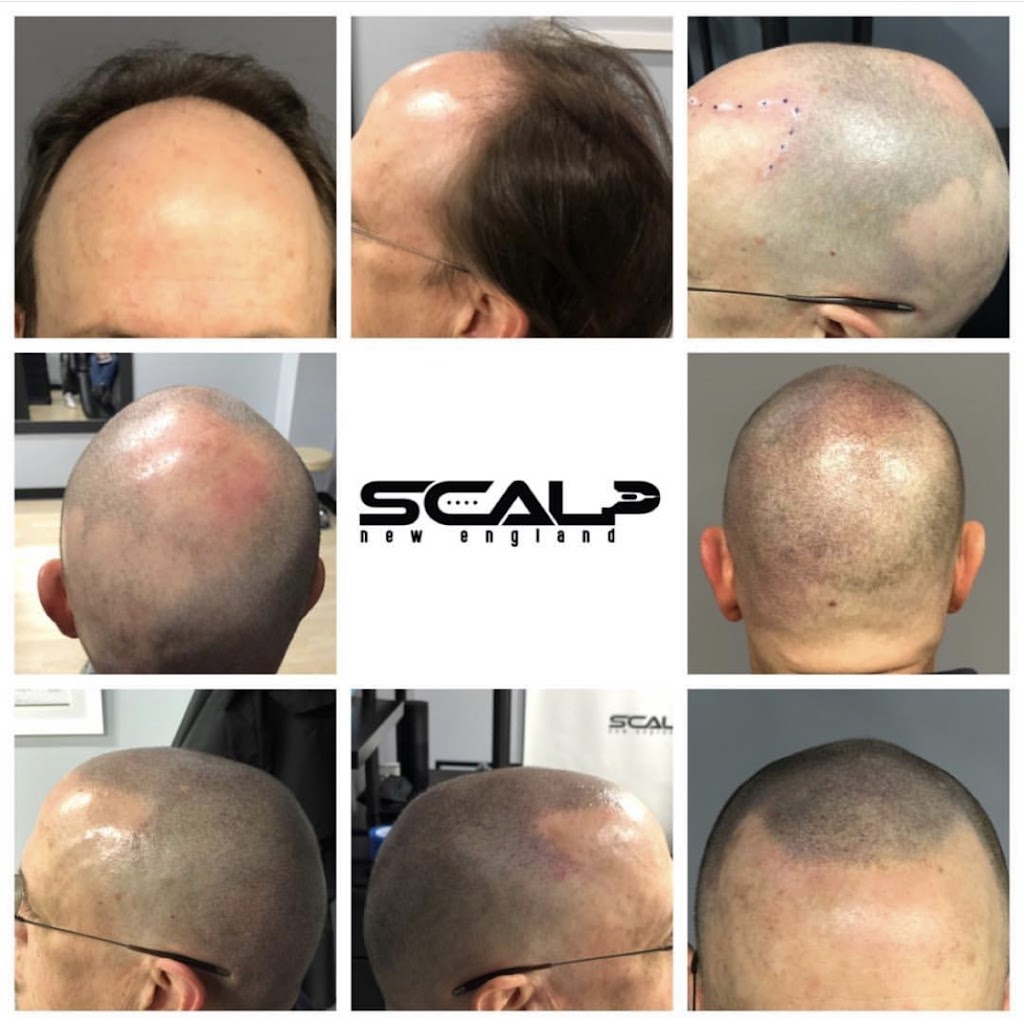 Scalp New England | 2 1st Avenue Door 103, suite 104-3, Peabody, MA 01960, USA | Phone: (978) 381-8075