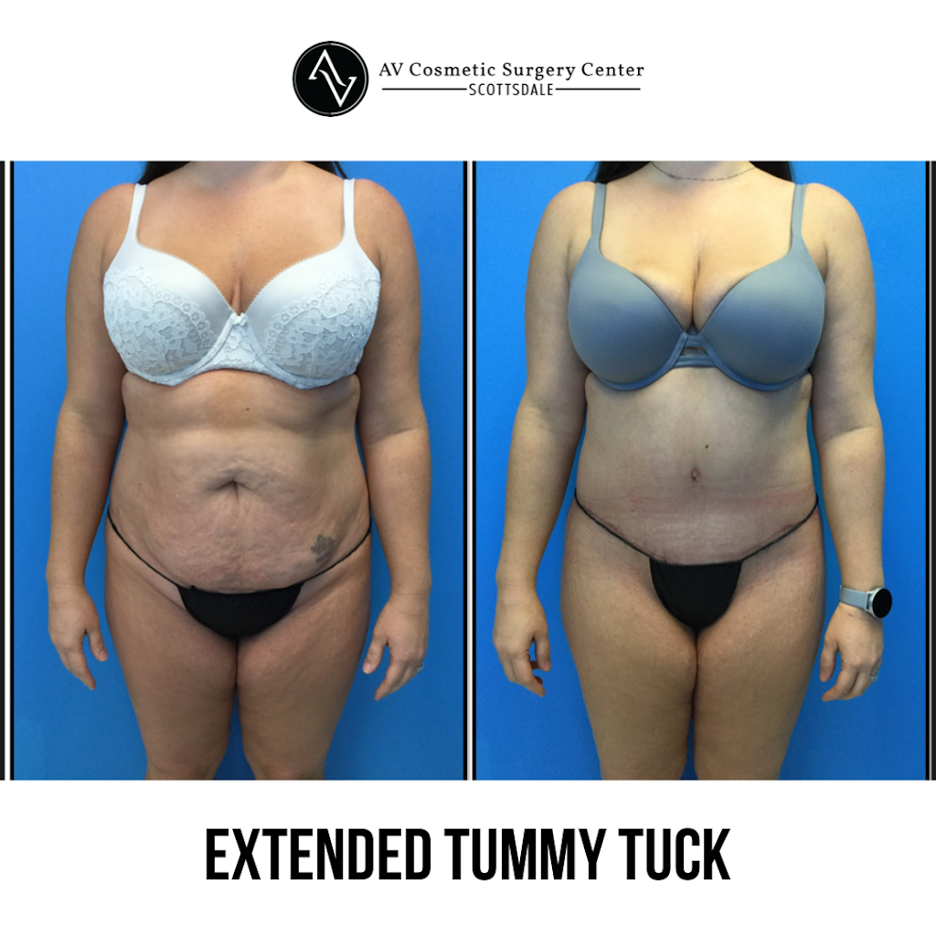 AV Cosmetic Surgery Center | 6930 E Chauncey Ln Suite 275, Phoenix, AZ 85054, USA | Phone: (480) 725-8627