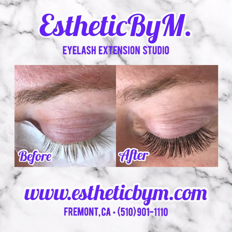 Esthetic By M | 43473 Boscell Rd Ste J3, Fremont, CA 94538, USA | Phone: (510) 901-1110